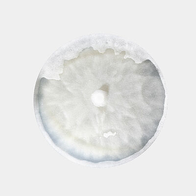 Damping-off Pythium aphanidermatum in petri dish